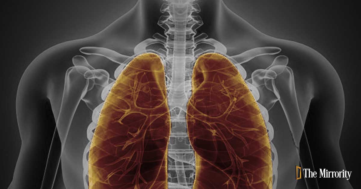 Tuberculosis (TB)| India | 2010 - 2022 | Data, Charts and Analysis ...